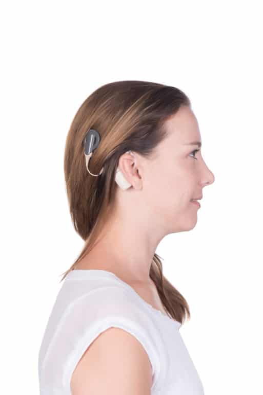 magneet jungle Permanent What is a Cochlear Implant? | Arizona Hearing Specialists | Blog